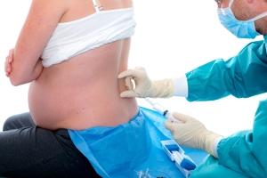 What You Need to Know About the Epidural